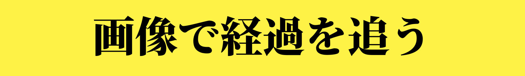 筋肉の歪みを整える