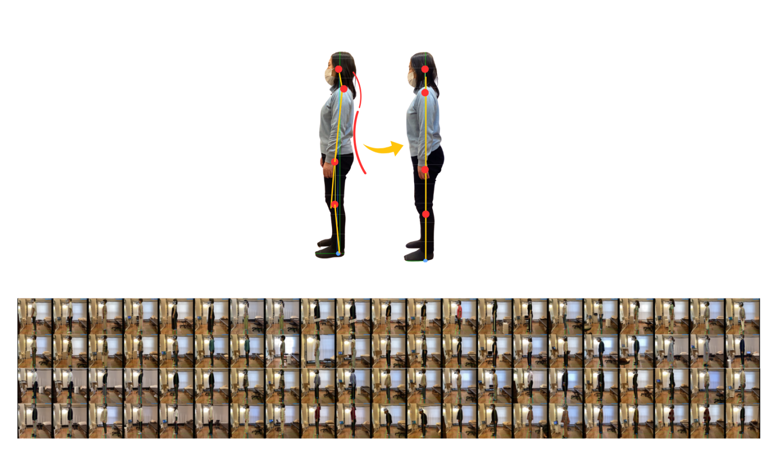 顎骨のイラストで不調がでやすいことを説明